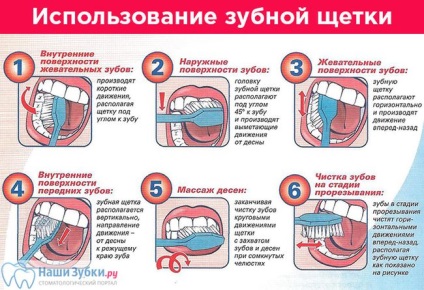 Igiena gurii 12 regulile igienei dentare și a gingiilor