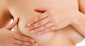 Granule Fordish pe sfarcurile, caracteristicile și tratamentul mamelonului