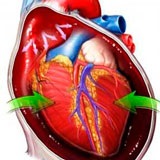 Clasificarea pericarditei - în mcb, etiologie