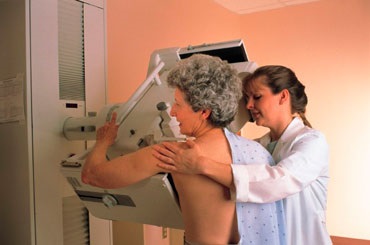 Când să faci mamografii