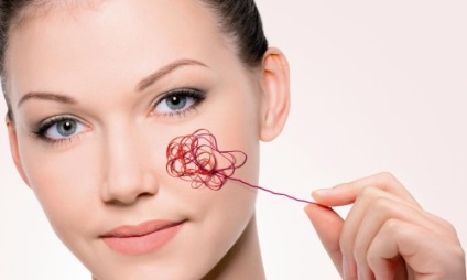 Tratament cu remedii folclorice rosacea