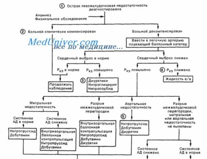 Eșecul ventriculului stâng la infarctul miocardic - diagnostic, tratament