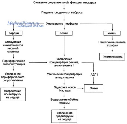 Eșecul ventriculului stâng la infarctul miocardic - diagnostic, tratament