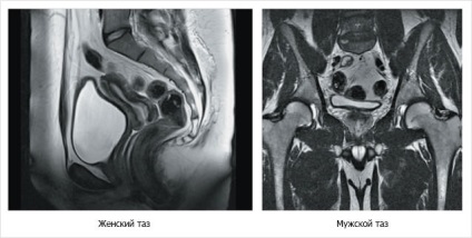 Anatomia de rezonanță magnetică a bazinului