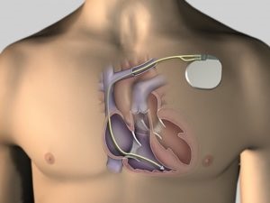 MRI a boka, ami azt mutatja, az MRI a boka, az ár a mágneses rezonanciás képalkotás