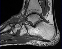 MRI a bokaízület - az árak Moszkvában talált 280 árak