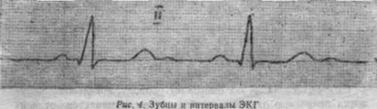 Normál EKG standard elvezetés