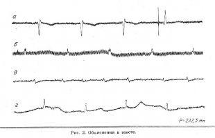 Caracteristicile înregistrării ecg în asistența medicală de urgență