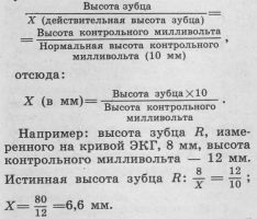 Caracteristicile înregistrării ecg în asistența medicală de urgență