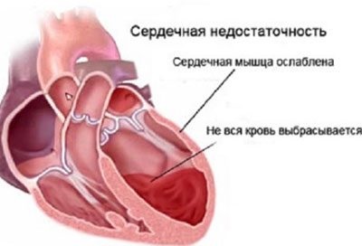 Agenți de agenți de vezică pentru blistere