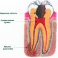 De ce este dintele bebelușului rătăcit ce să facă, stomatologie