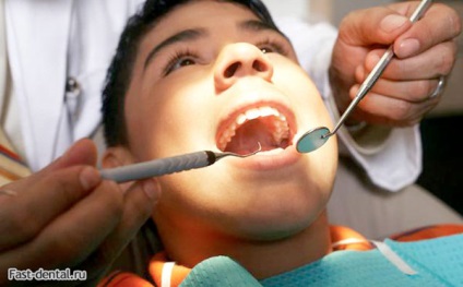 De ce este dintele bebelușului rătăcit ce să facă, stomatologie