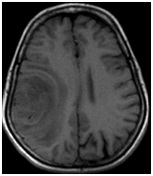 Centrul Regional de Diagnosticare - mrt, kt, tomografie, uzi