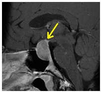 Centrul Regional de Diagnosticare - mrt, kt, tomografie, uzi