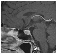 Centrul Regional de Diagnosticare - mrt, kt, tomografie, uzi