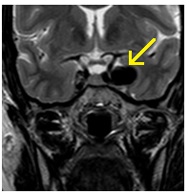 Диагностичен център за регионално - MRI, CT, томография, ултразвук