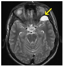 Centrul Regional de Diagnosticare - mrt, kt, tomografie, uzi