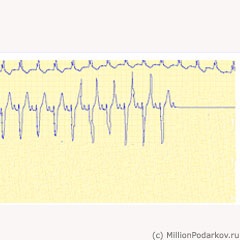 Cardiogramă cardiacă cu mâinile mele