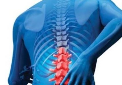 Fuzionate 5-7 vertebre, hemangiom - cum să se vindece