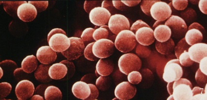 Staphylococcus aureus (Staphylococcus aureus) - sensibilitate la antibiotice, mrsa, mssa,