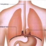 Simptomele de îngustare a esofagului și tratamentul, wiki esophagus
