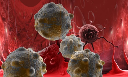 Trichomonadal teoria fistulei Tamara