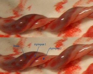 Uzi a terhesség alatt 22 hét, a sebesség, a mutatók, amelyek úgy néznek