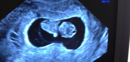 Uzi a terhesség alatt 22 hét, a sebesség, a mutatók, amelyek úgy néznek