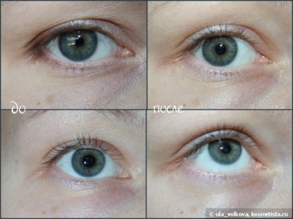 3D kollagén szem regeneráló krém (regeneráló krém a szem körüli bőr kollagén 3d) véleménye