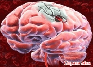5 moduri de a crește fluxul de sânge la creier - mame de țară