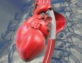 Presiunea centrală a aortei și rigiditatea vaselor sunt actuale în cardiologia modernă