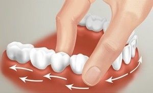 Ce să faci dacă dinții au început să se scalde