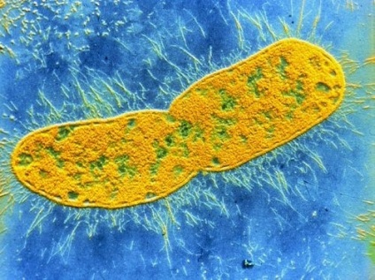 Ciprofloxacin - a használati utasítást, javallatok, ellenjavallatok