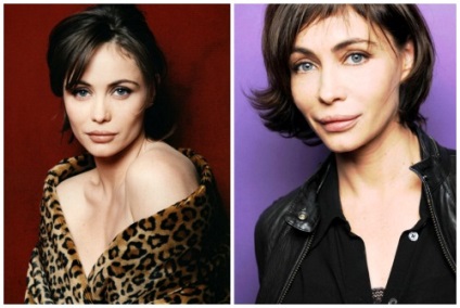 Emmanuelle Beart ifjúkori előtt és után plasztikai sebészet fotók és videó