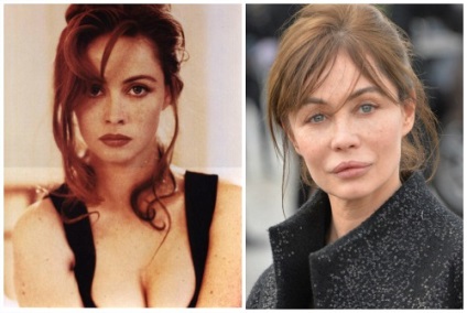 Emmanuelle Beart ifjúkori előtt és után plasztikai sebészet fotók és videó