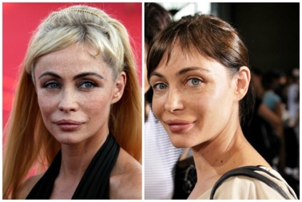 Emmanuelle Beart ifjúkori előtt és után plasztikai sebészet fotók és videó