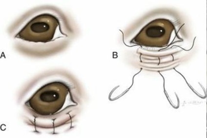 Entropium (inverzió század), állatorvosi klinikán Dr. Shubin