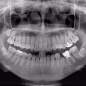 În cazul în care pentru a vindeca un dinte ieftin la Moscova, metode de tratament, prețurile în stomatologie, un medic dentist