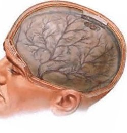 Hidrocefalul tratamentului cerebral prin metode folclorice și clinice