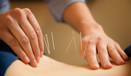 Acupunctura pentru revizuirea pierderii în greutate este subțire