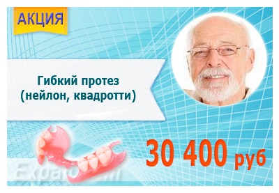 Azonnali fogsorok típusú protézisek és olcsó költség