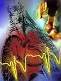 Infarctul miocardic factori de risc, simptome, prevenirea - tratamentul bolilor cardiace și vasculare