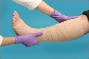 Cum să îmbrăcați un picior cu vene varicoase