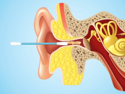 Как правилно да се почисти ушите - така опасно, отколкото клечки за уши