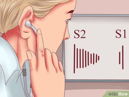Hogyan végezzen szív hallgatózás