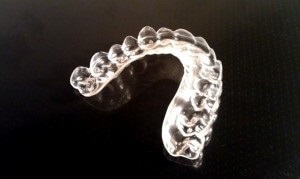 Capa cu tipuri de bruxism, procedura de fabricatie, preturi