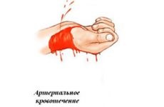 Vérzés kezelése népi jogorvoslati