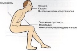 Tratamentul dispneei cu insuficiență cardiacă