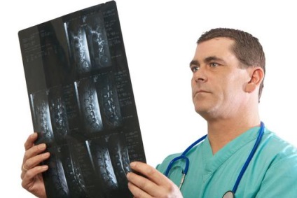 Lordosis - ez az oka a betegség, a tünetek, diagnózis és a kezelés a (betegség) Lordosis - ez a betegség oka, a tünetek, diagnózis és kezelés
