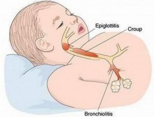 Diagnosticarea și tratarea canalului fals